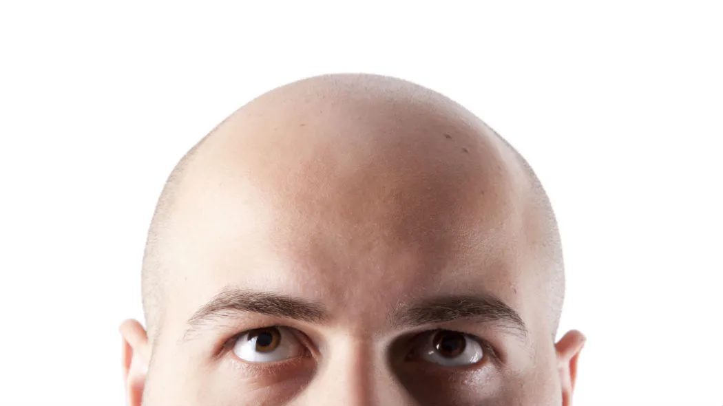 Caduta di capelli: e se dipendesse da una cattiva alimentazione?